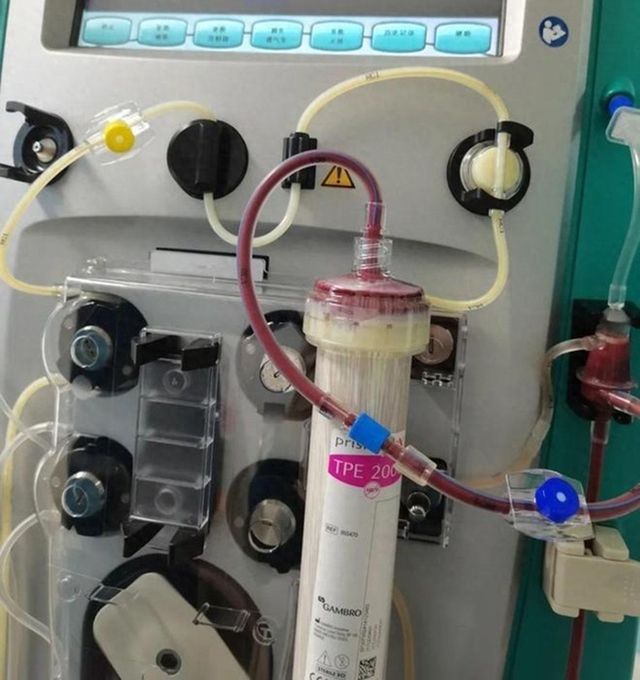 Chàng trai 19 tuổi máu đục như sữa, suy đa tạng nguy kịch vì 2 kiểu LƯỜI người trẻ rất thích chang trai 19 tuoi mau duc nhu sua suy da tang nguy kich vi 2 kieu luoi nguoi tre rat thich