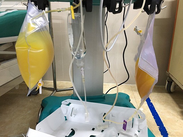 Hút ra gần 2 lít "dầu" từ trong máu người phụ nữ "thập tử nhất sinh" vì ăn thịt lợn kiểu này
